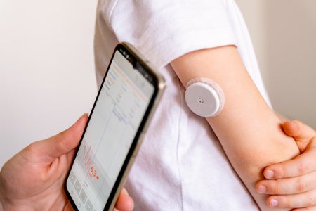 A continuous glucose monitor is shown on a teen's arm.