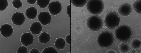 Cortical organoids carrying archaic NOVA1 (left) and modern NOVA1 (right) differ in shape and in neuron development.