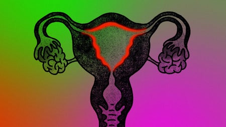 An illustration of the female reproductive system