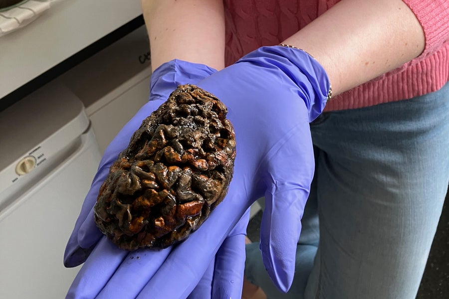 Photo of preserved brain at Oxford University being held by gloved hands