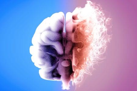 Creative digital illustration of a brain viewed from the front as it disintegrates into a vapor-like cloud