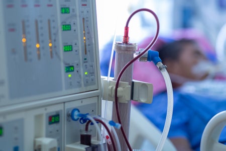 Dialysis machine close up with display, cables and a patient in background.