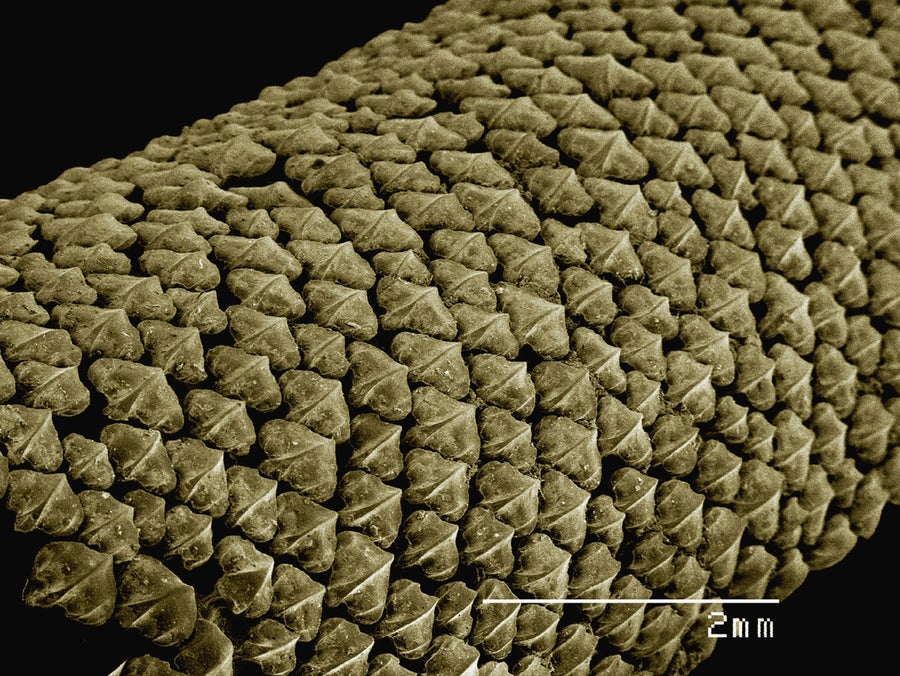 Coloured SEM of shark skin